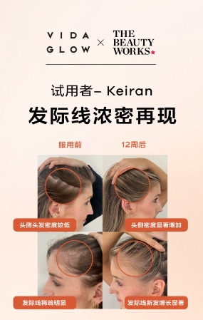 点击查看原始图片