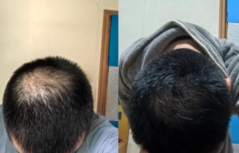 360ͼ20250828182314720.jpg